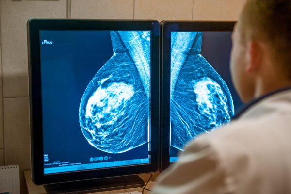3d imaging of breasts