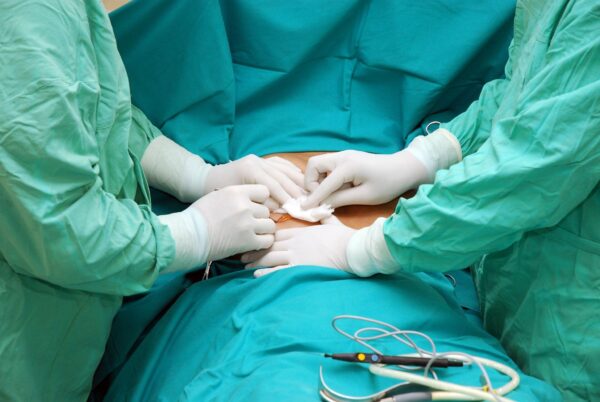 doctors doing breast implant surgery
